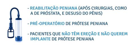 Bomba peniana: entenda como pode ajudar no seu。